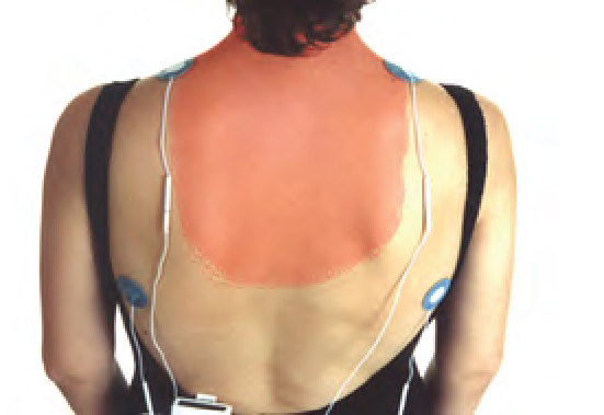 neck-and-shoulder-pain-03